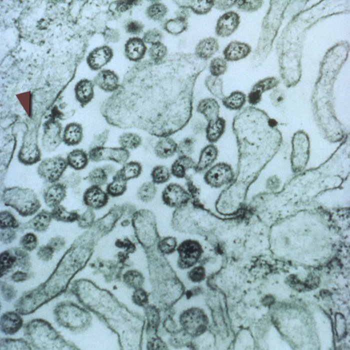 You might have seen that we’re contact tracing after an individual travelled to England while unwell with #LassaFever. 🔍📰
Want to know the facts on the illness? Our latest blog post covers everything you need to know. 📖👇
ukhsa.blog.gov.uk/2025/03/07/wha…