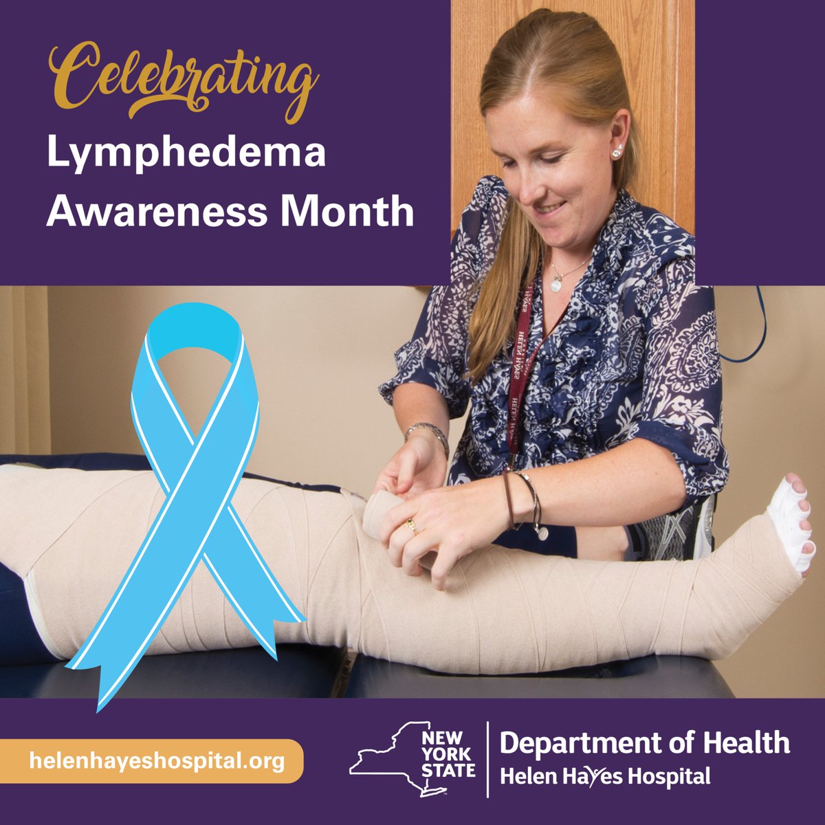 Lymphedema, a chronic swelling condition,  affects over 250 million people worldwide. Learn how our comprehensive Lymphedema Program and complete decongestive therapy can help you: helenhayeshospital.org/lymphedema #LymphedemaAwarenessMonth