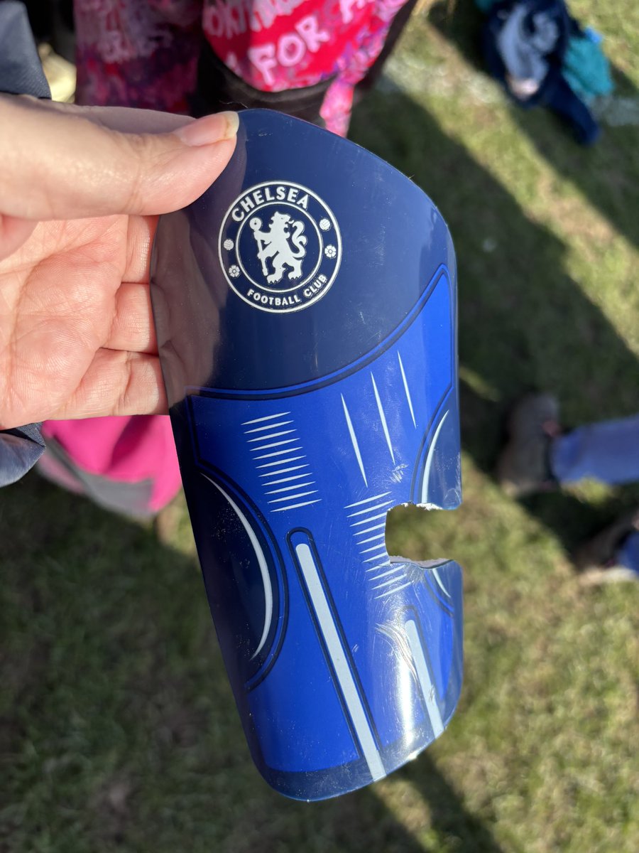 kelliwynn's tweet photo. Please do not buy your kids the Chelsea shin guards from the store at Stamford bridge. The result of a light tackle in a girls under 9 match so not stuff of battles.  This is not a complaint just a warning to other parents. @ChelseaFCW https://t.co/OavtIEjwBY