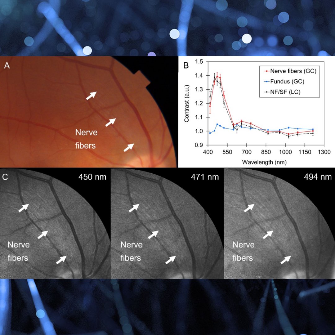 🔬 To advance retinal oximetry &amp; automated diagnosis:
✔️ They will explore new imaging modalities like Raman spectroscopy.
✔️ Apply DL frameworks to enhance diagnostic accuracy.
📷 A spectral retinograph shows the contrast of different structures!
👉 Stay tuned! #VisionResearch