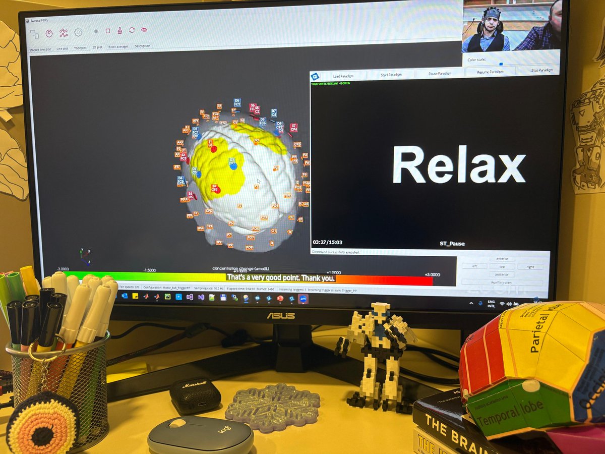 EEG-fNIRS lectures = brain fully activated! If only I could wear an fNIRS cap daily to monitor my overthinking levels 🧠 🚀
#Multimodal_Imaging #TooMuchBrainPower