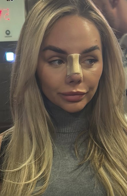 Watch ✖️EMILIE-RAE✖️'s leaked NSFW photo on TwXstars