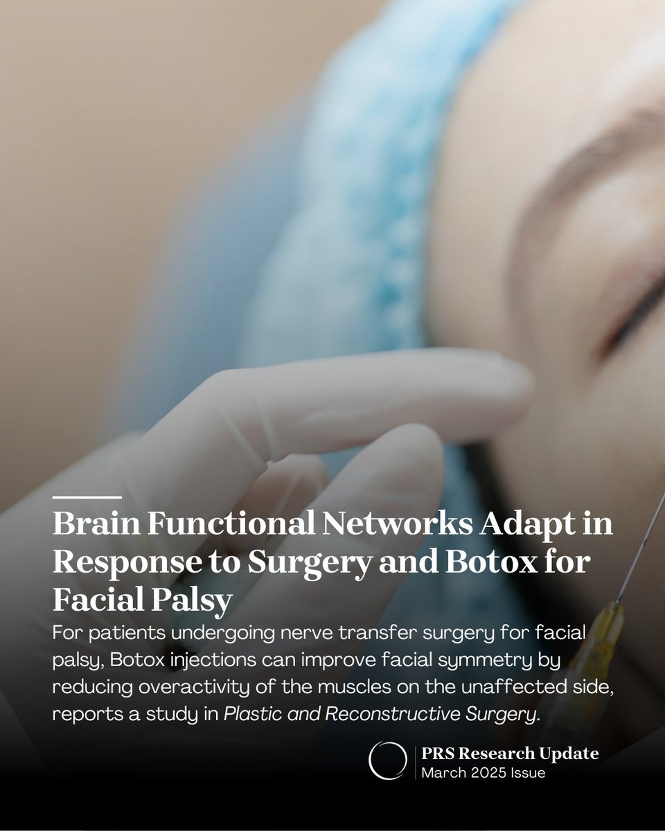 ASPS_News's tweet image. Botox for more than just wrinkles? A new study in @PRSJournal reveals that Botox injections can help facial palsy patients improve facial symmetry after nerve transfer surgery by relaxing muscles on the unaffected side. bit.ly/3FiSMV9

#FacialPalsy #FacialParalysis