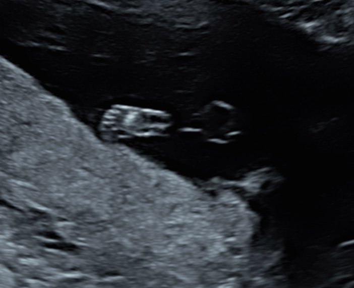 Mein Großprojekt dieses Jahr 🥰❤️🤰