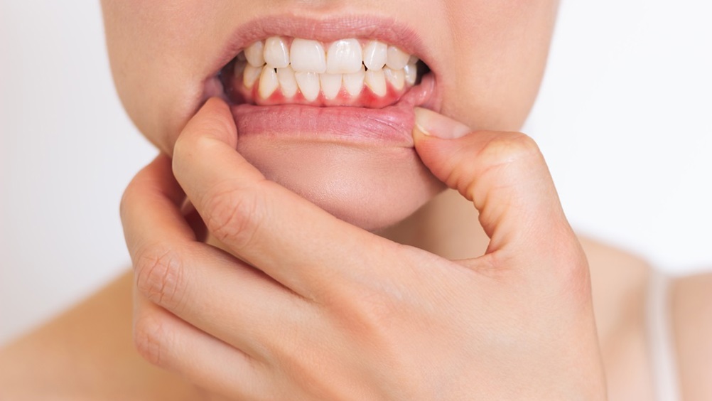 TheDentistMag (@thedentistmag) on Twitter photo Systemic and local inflammation may be reduced by a fasting-mimicking diet, say researchers from <a href="/KingsCollegeLon/">King's College London</a>.
Find out more about the study here:
➡️ ow.ly/t6CY50VeX9X
#oralhealth #inflammation #periodontaldisease #diet #fasting #study #dental #dentistry Systemic and local inflammation may be reduced by a fasting-mimicking diet, say researchers from <a href="/KingsCollegeLon/">King's College London</a>.
Find out more about the study here:
➡️ ow.ly/t6CY50VeX9X
#oralhealth #inflammation #periodontaldisease #diet #fasting #study #dental #dentistry