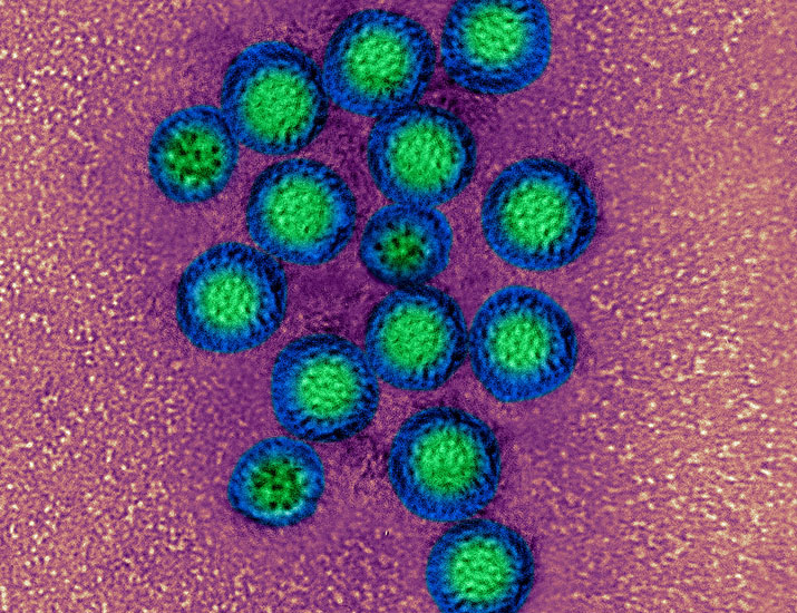 Science Magazine (@sciencemagazine) on Twitter photo An oral tablet vaccine for norovirus based on an adenoviral-vectored vaccine that delivers VP1 is safe in older adults and produces a notable antibody response in the mucosa that persists for 210 days, according to results from a phase 1 trial.
Learn more in <a href="/ScienceTM/">Science Translational Medicine</a>: An oral tablet vaccine for norovirus based on an adenoviral-vectored vaccine that delivers VP1 is safe in older adults and produces a notable antibody response in the mucosa that persists for 210 days, according to results from a phase 1 trial.
Learn more in <a href="/ScienceTM/">Science Translational Medicine</a>:
