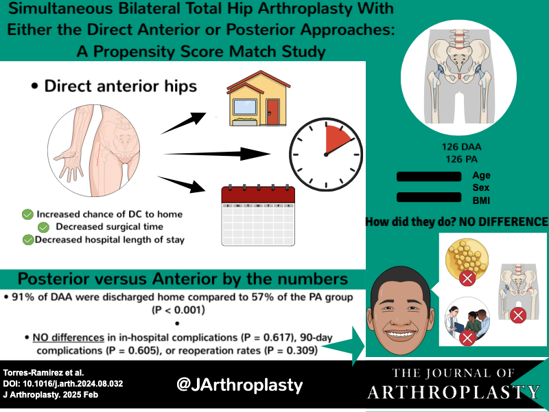 A simultaneous bilateral THA, either through the DAA or PA, can be safely performed with low complication rates. DAA in the setting of SBTHA provides shorter surgical times, a shorter LOS, and a greater percentage of patients DC home.

arthroplastyjournal.org/article/S0883-…