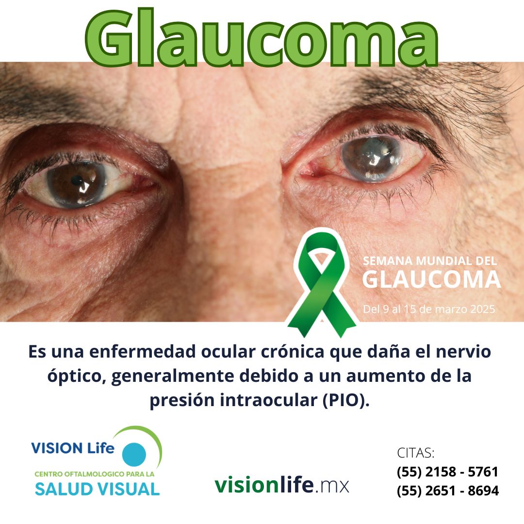 VisionLifemx's tweet photo. Asegúrate de cuidar tus ojos 👀 y programa una cita con nuestros especialistas en oftalmología HOY mismo

👉https://t.co/5srEJ4QOfz

🕻 CITAS: (55) 2158 - 5761 y (55) 2651 - 8694 

#VisionLife #SaludVisual #OptometriaenAragon #Catarata #Glaucoma #SaludOcular #CirugiadeCatarata https://t.co/G4QR4oxg6Y