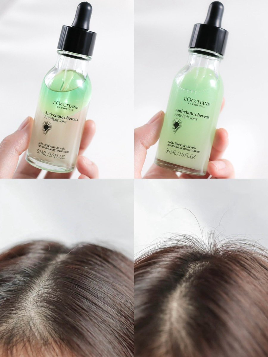 L’Occitane Anti Hair Loss💆🏻‍♀️ใช้แล้วเห็นผลจริง! ตัวนี้เป็นเซรั่มลดผมร่วง และช่วยให้ผมขึ้นใหม่ ลองใช้สองสัปดาห์ก็เห็นผลแล้ว ผมร่วงน้อยลงแบบสุดๆ วิธีใช้คือเขย่าๆ หยดแล้วนวดๆหลังสระผม ไม่มีอีกแล้วคนสวยผมบาง ขอมีแต่ฟาร์มผมสวยเท่านั้น🤭 https://t.co/8YjHE2f7eF
