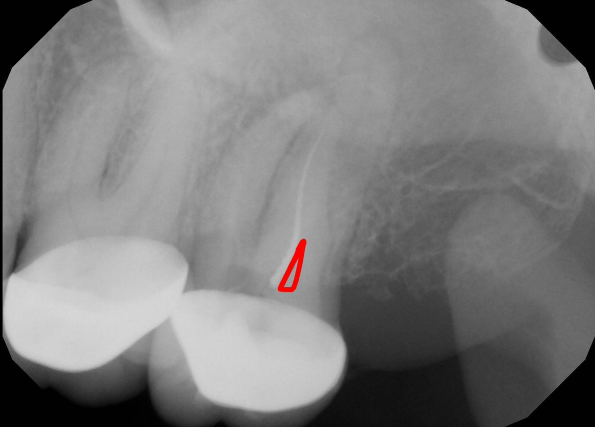 DrRootCanal tweet media