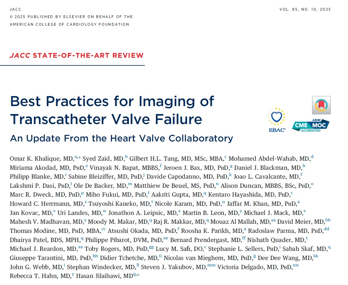 Dr. Gilbert Tang (@gilberttangmd) on Twitter photo Just out <a href="/JACCJournals/">JACC Journals</a> #HeartValveCollaboratory consensus document on imaging transcatheter valve failure (#TAVR) from our 9/2023 #TAV reintervention workshop. Congrats <a href="/OKhaliqueMD/">Omar Khalique</a> <a href="/TheLADoctor/">Hasan Jilaihawi</a> <a href="/SyedZaidMD/">Syed Zaid, MD</a> et al for this tremendous effort. Proud to be part of this. Just out <a href="/JACCJournals/">JACC Journals</a> #HeartValveCollaboratory consensus document on imaging transcatheter valve failure (#TAVR) from our 9/2023 #TAV reintervention workshop. Congrats <a href="/OKhaliqueMD/">Omar Khalique</a> <a href="/TheLADoctor/">Hasan Jilaihawi</a> <a href="/SyedZaidMD/">Syed Zaid, MD</a> et al for this tremendous effort. Proud to be part of this.
