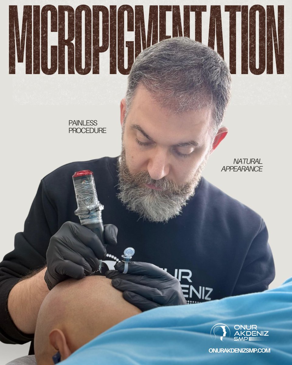 onurakdenizsmp's tweet image. Precision. Confidence. Transformation. 🖌️✨ Scalp Micropigmentation is the art of creating a natural look with a painless procedure—giving you the confidence you deserve! Ready for your transformation? Let’s make it happen! 💪

#scalpmicropigmentation #micropigmentation…