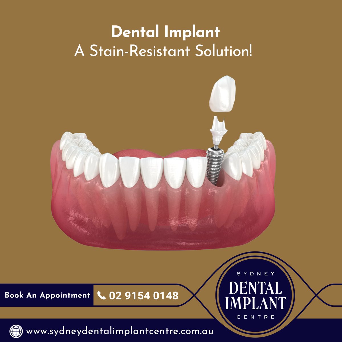 sydneydentalimp's tweet image. Dental implants are stain-resistant, so you can enjoy your favourite coffee, tea, or even red wine without worry! Dental implants are made from materials that resist staining, helping you maintain a beautiful, bright smile for years to come.
#DentalImplants #StainResistant