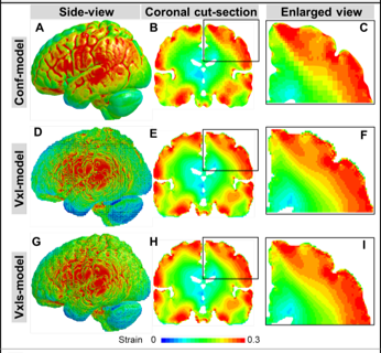 Can we develop a high-quality, hexahedral-meshed head model with authentical geometry? Our latest study presented one surface-based and two voxel-based meshing techniques to achieve this and quantified the differences among them.
link.springer.com/article/10.100…