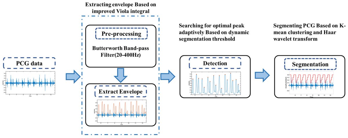 Applsci's tweet image. 🔥 Read our Paper
📚 Optimal Heart Sound Segmentation Algorithm Based on K-Mean Clustering and Wavelet Transform
🔗 mdpi.com/2076-3417/13/2…
👨🔬 by Dr. Xingchen Xu et al.
🏫 @UCAS1978
#cardiovasculardisease #featureextraction