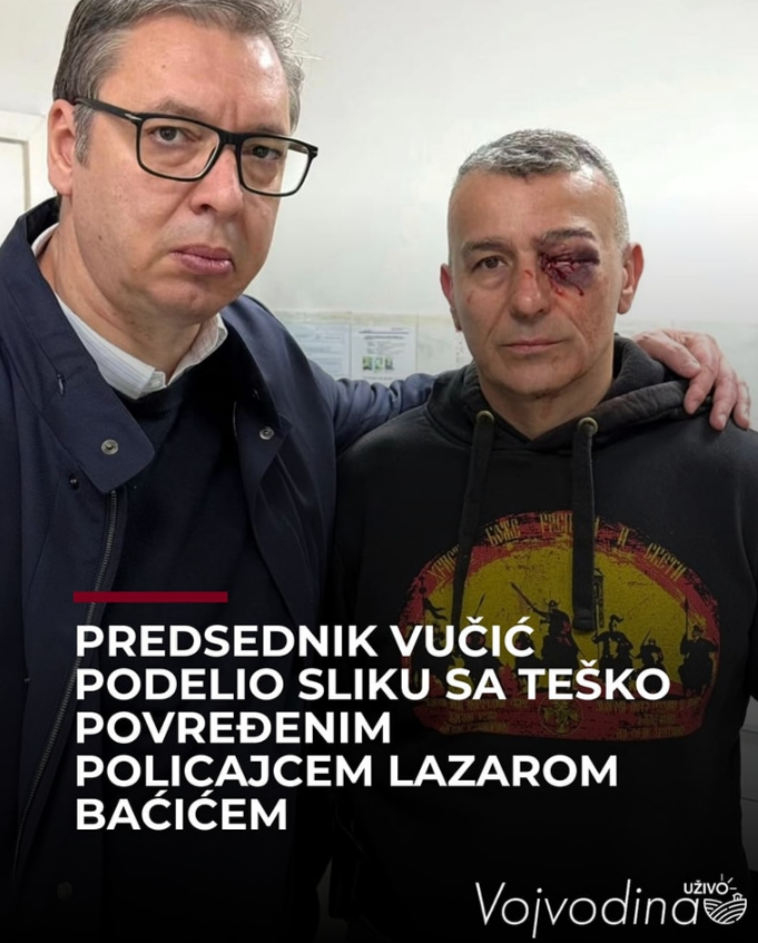 VojvodinaUzivo's tweet photo. Teške povrede policajca Lazara Baćića ispred RTS-a – udaren bokserom od nasilnika. Ovo nije mirni protest, ovo je nasilje! Pravda će stići. #Srbija #Beograd #RTS #Pravda #Nasilje

https://t.co/7kubgoZzF2 https://t.co/M2pCjwFbi5