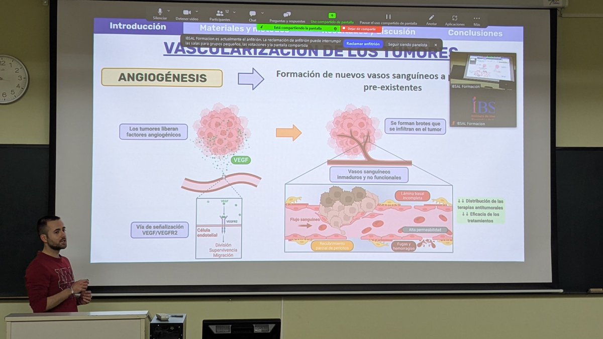 IBSAL_IIS's tweet photo. 🎓 #SeminarioPREDOC | Iván Carrera Aguado, investigador predoc del @IBSAL_IIS y @usal, nos presenta su tesis sobre la inhibición de las integrinas αvβ3/αvβ5 en el crecimiento tumoral y en metástasis experimentales de pulmón 🫁

👉 Comunidad PreDoc IBSAL: https://t.co/iyKZFGFpSn https://t.co/wpZr9Ldgxo