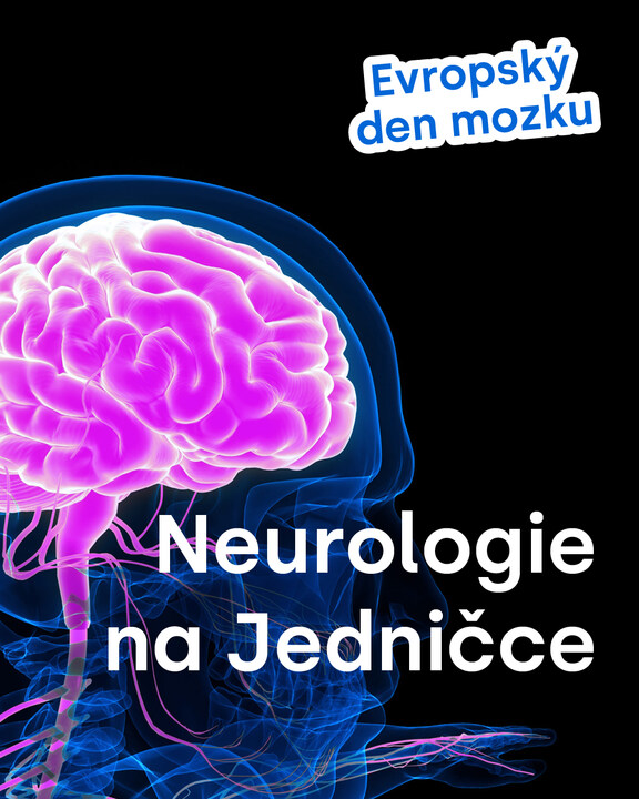 🧠 Dnes je Evropský den mozku –  promluvme si o migréně!  
Není to jen obyčejná bolest, ale velmi časté neurologické onemocnění, které se projevuje záchvaty bolesti hlavy. Ty dovedou člověka vyřadit i z běžné činnosti.  
🎧 Chcete se dozvědět víc?  
kont.ly/bc4ded22
