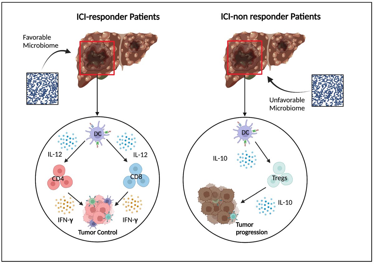 😊Check out #review: HCC and Immunotherapy: The Potential Predictive Role of Gut Microbiota and Future Therapeutic Strategies #hepatocellularcarcinoma
<a href="/MDPIOpenAccess/">MDPI</a> <a href="/MdpiOnco/">Onco_MDPI</a> 
👨‍🎓Author: by Carmelo Laface, Eleonora Lauricella and Girolamo Ranieri et al
👏 mdpi.com/2673-7523/5/1/9