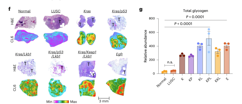 Ramon Sun (@rcsunlab) on Twitter photo Super excited to share our latest work published today in <a href="/NatMetabolism/">Nature Metabolism</a> handled by the amazing Alfredo Gimenez-Cassina. We showed western diet driven lung glycogen accumulation is a driver of both early tumorigenesis and progression.
rdcu.be/ec3lZ Super excited to share our latest work published today in <a href="/NatMetabolism/">Nature Metabolism</a> handled by the amazing Alfredo Gimenez-Cassina. We showed western diet driven lung glycogen accumulation is a driver of both early tumorigenesis and progression.
rdcu.be/ec3lZ