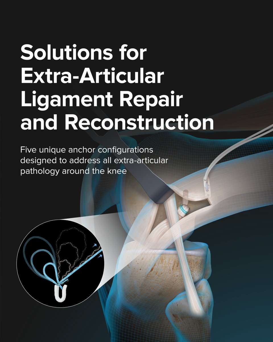 ArthrexMedEd's tweet image. With a focus on precise instrumentation and a drive for constant innovation, #Arthrex offers knee products and techniques designed to optimize the operative experience and deliver positive patient outcomes. Get hands-on experience with our newest knee solutions at the #AAOS 2025…