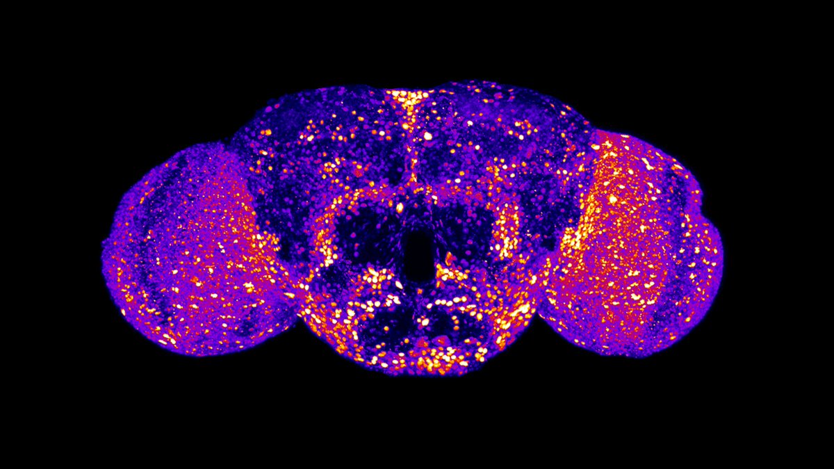 RaidenScience's tweet image. This is a prime example of why NIH funding is so critical for rare disease research, especially in the early stages of developing genetic models to understand diseases like UBA5 disorder better.
We are featured in the article.
orip.nih.gov/about-orip/res…