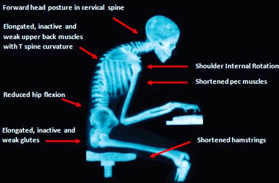 3 exercises that should be mandatory for people who sit at desks: