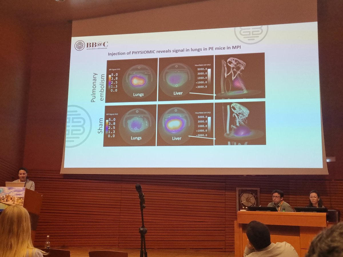 Come and check out Charlène <a href="/JacqmarcqC/">Jacqmarcq Charlène</a> poster at the EMIM2025 and her work from the <a href="/BbCaen/">Institut BB@C</a> on pulmonary emblism imaging via Magnetic Particle Imaging 
#MPI #EMIM2025