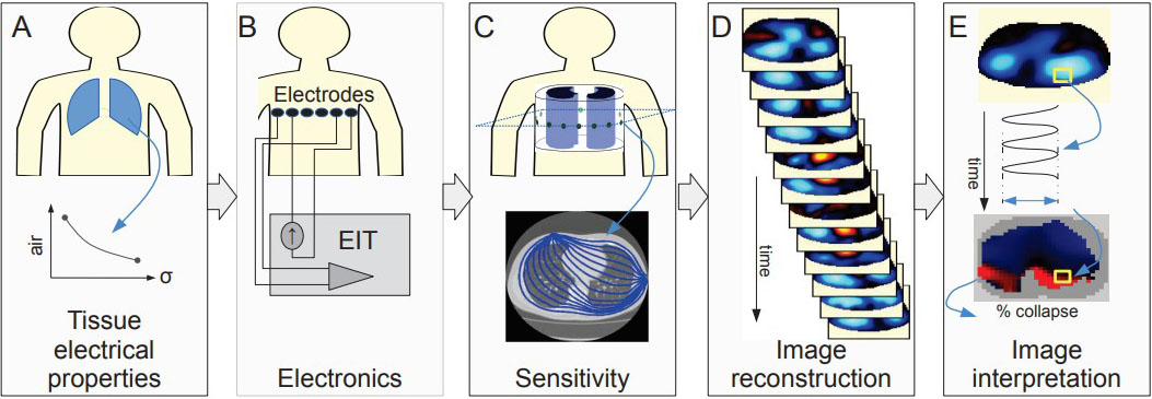 TheSIAMNews's tweet image. At #SIAMCSE25, Jacob Roarty of @ASU utilized electrical impedance #tomography #data to compare image reconstruction techniques—including iterative, noniterative, &amp;amp; #machinelearning processes—that identify &amp;amp; locate anomalies in the human body. Read more! siam.org/publications/s…