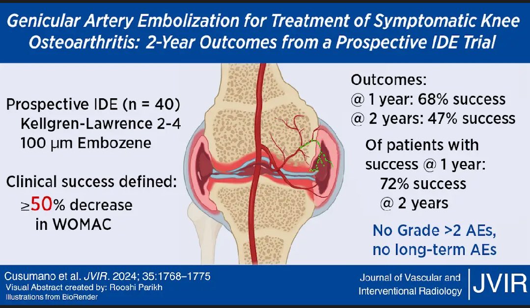JVIR (@jvirmedia) on Twitter photo Great new visual abstract on geniculate artery #embolization for patients with knee pain from arthritis. Excellent to see prospective data base and trials in this space run by #IRad.
Shout out to <a href="/RooshiParikh/">Rooshi Parikh</a> for putting together! Great new visual abstract on geniculate artery #embolization for patients with knee pain from arthritis. Excellent to see prospective data base and trials in this space run by #IRad.
Shout out to <a href="/RooshiParikh/">Rooshi Parikh</a> for putting together!