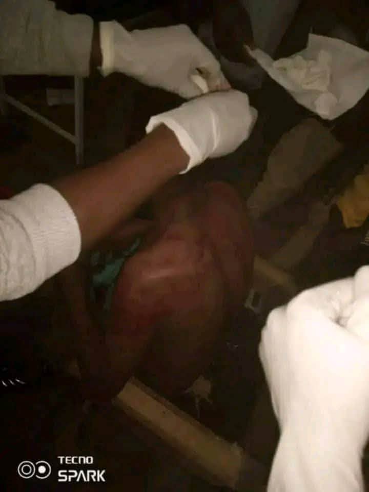 RTekeze's tweet photo. 4. Abadi, Head of Security, A. Gudem
 Shot by the army and in treatment
 1. Alemu Haile G/Hiwet Zone 1D in his head,
 2. Mogos Kidanu WolduKetena 1d on his chest,
 3. Woldu Abadi Tesfay, Zone 2, on his lap,
 4. Mogos Kahsu Berhe, Zone 4, was beaten in the hand. https://t.co/uxOTP0LnBG