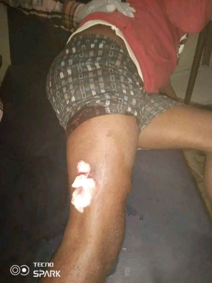 Peak Cruelty Army
 Abducted by Army 44 Corps 1(Asme Commander) Manjur Division on patrol
 1. Engineer Amdom Woldu, Mayor of Adi Gudem
 2. Awet Tewolde, Deputy Mayor of Adi Gudem
 3. Mr. Yirga Past Public Relations and Mobilization
 4. Abadi, Head of Security, A. Gudem