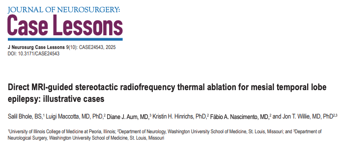 Fábio Nascimento (@fabnascimen) on Twitter photo In select cases, #RFA can provide an alternative to #LITT for treating focal #epilepsy. Great work by <a href="/JTWillieMD/">Jon T. Willie, MD, PhD</a> and group. <a href="/WashUNeurology/">WashU Medicine Neurology</a> <a href="/washuepilepsy/">WashU Medicine Epilepsy</a> <a href="/EEGTalk/">EEGTalk</a>
pubmed.ncbi.nlm.nih.gov/40064001/ In select cases, #RFA can provide an alternative to #LITT for treating focal #epilepsy. Great work by <a href="/JTWillieMD/">Jon T. Willie, MD, PhD</a> and group. <a href="/WashUNeurology/">WashU Medicine Neurology</a> <a href="/washuepilepsy/">WashU Medicine Epilepsy</a> <a href="/EEGTalk/">EEGTalk</a>
pubmed.ncbi.nlm.nih.gov/40064001/