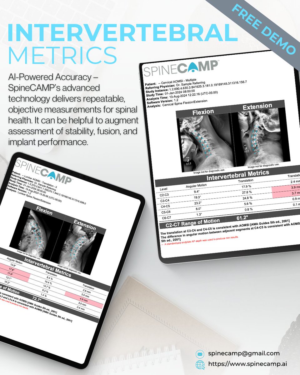 SpineCAMP's tweet photo. Accurate imaging is key to assessing spinal health, and SpineCAMP provides clinicians with objective, AI-powered metrics to help make informed decisions. 
The metrics produced by SpineCAMP are intended to be used to support qualified and licensed professionals. https://t.co/nH5dHg2p0q