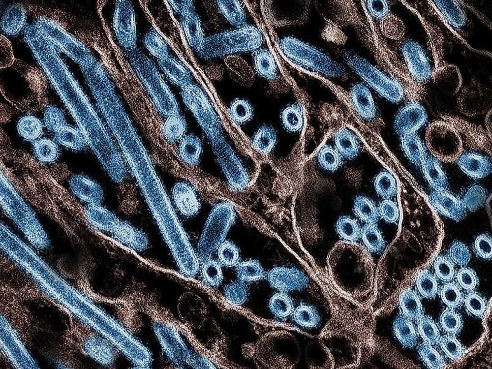Dean Regier: Canada must step up as the global leader in pandemic preparedness vancouversun.com/opinion/op-ed/…