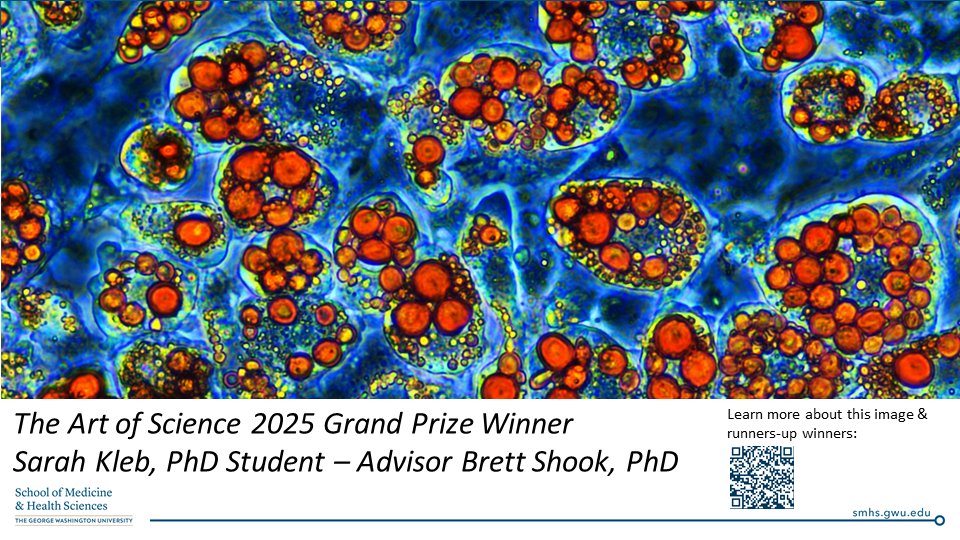 GW_IBS's tweet image. A new cover photo for 2025 courtesy of #GWIBSFamily PhD student Sarah Kleb, who won this year's Art of Science contest! Thank you to Sarah and her mentor @ShookLab for this image of 3T3-L1 fibroblasts that have been differentiated into adipocytes 🎨 🖼️ 🔬 smhs.gwu.edu/research/resea…