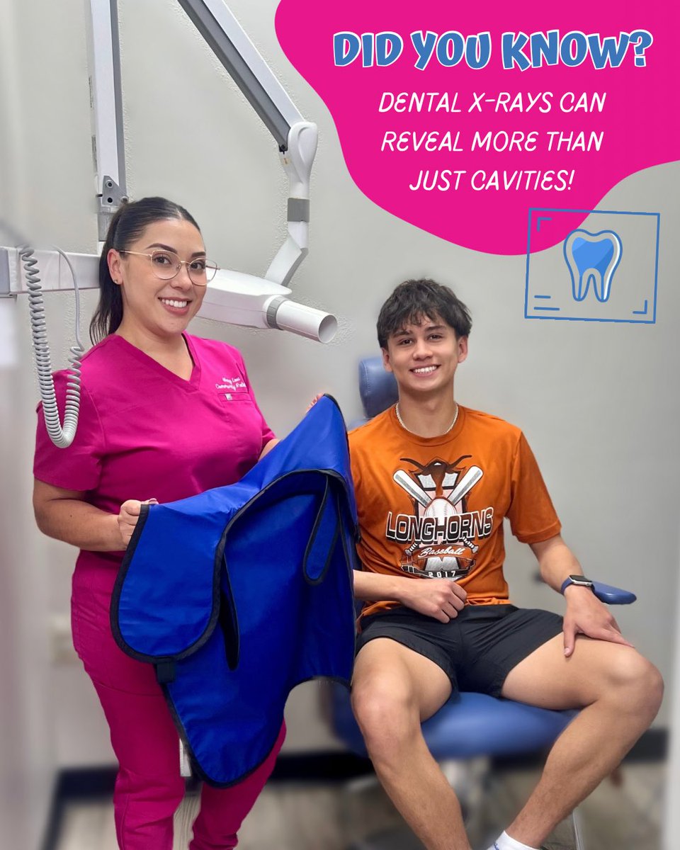 Did you know? Dental X-rays can reveal more than just cavities! 📸🦷 X-rays are a safe, quick, and essential tool to catch dental issues before they turn into bigger problems. Regular checkups + X-rays = A healthy, happy smile for your little one! Book at epd4k.com