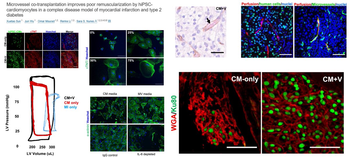 Microvessel (purified from rat adipose) - #hiPSC-cardiomyocyte cotransplantation
👉&gt;100-fold⏫hiPSC-CM engraftment
👉⏫heart functional recovery ( FS EF)
in Diabetic rat #MyocardialInfarction #T2D

A potential role of #Angiocrine IL6🤠

<a href="/YYZscientist/">Dr. Sara Nunes Vasconcelos (she/her) 🇨🇦🇧🇷</a> <a href="/stemcellreports/">StemCellReports</a> 2025