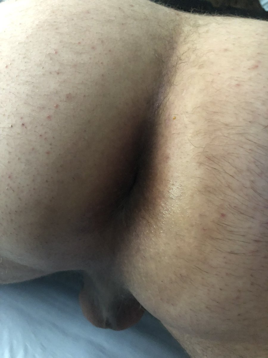 ShyZebraAD's tweet photo. @himbohyena Come and get it sometime~ https://t.co/eRhJ979TzX