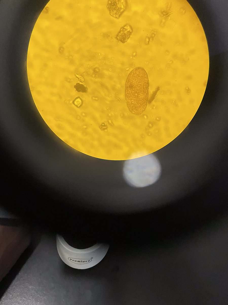 Rita Nyaaba Akologo (@akologorita) on Twitter photo Day 2 on our study (investigating the efficacy of antihelminthic drugs among children) Dedicating 5 to 10hrs analyzing collected samples in the lab. and identifying various types of parasites: S. mansoni &haematobium, Ascaris Lumbicoids, T.T, and hookworm was fascinating <a href="/RSTMH/">Royal Society of Tropical Medicine and Hygiene</a> Day 2 on our study (investigating the efficacy of antihelminthic drugs among children) Dedicating 5 to 10hrs analyzing collected samples in the lab. and identifying various types of parasites: S. mansoni &haematobium, Ascaris Lumbicoids, T.T, and hookworm was fascinating <a href="/RSTMH/">Royal Society of Tropical Medicine and Hygiene</a>