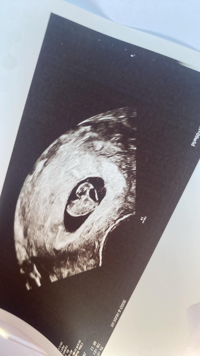 My sister just sent me the most adorable Ultrasound of her baby😭