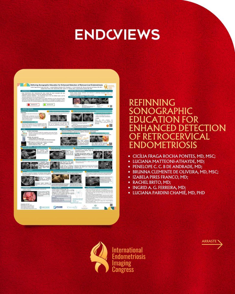endoviews's tweet image. Confira os trabalhos científicos apresentados no International Endometriosis Imaging Congress (EICE)! Nos dias 8 e 9 de março, em Miami, Flórida, tivemos a honra de apresentar três trabalhos científicos, reforçando a importância da imagem no diagnóstico e manejo da endometriose.