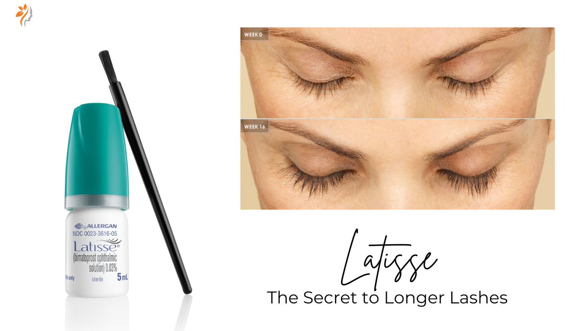 Ditch the falsies! Latisse is a dermatologist-approved solution for longer, fuller lashes in just a few weeks. 

Say hello to your natural lash transformation! 😍
 
 #Lashgoals #latisselashes  #eyelashgrowth #skincaretoronto #lashserum