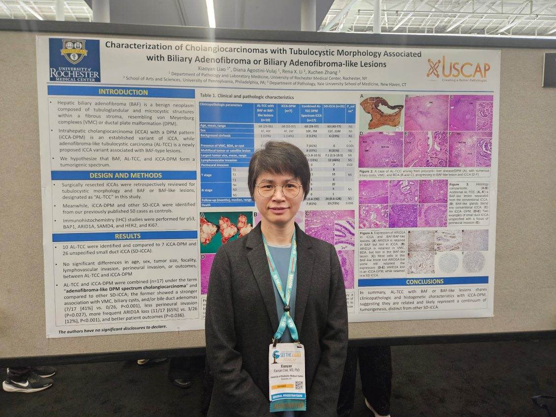 Our amazing faculty members presenting at this mornings poster session. Drs. Diana Agostini-Vulaj, Brian Finkelman &amp; Xiaoyan Liao.

#PathTwitter 
#PathX 
#Pathology 
#USCAP2025
<a href="/TheUSCAP/">USCAP</a>
<a href="/AgostiniVulajDO/">Diana Agostini-Vulaj</a>
#pathresidency #pathologyresidency
#path2path #pathresidents