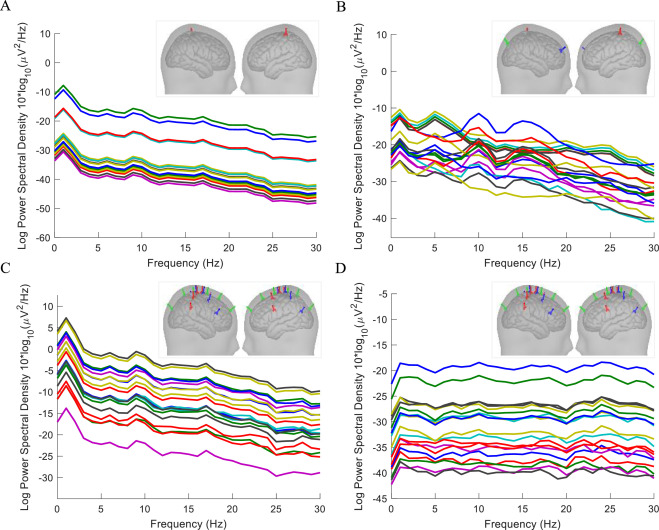 BraitLab's tweet photo. PaLOSi paper is out in https://t.co/3V7uhR1rrm https://t.co/i6f02HY66O