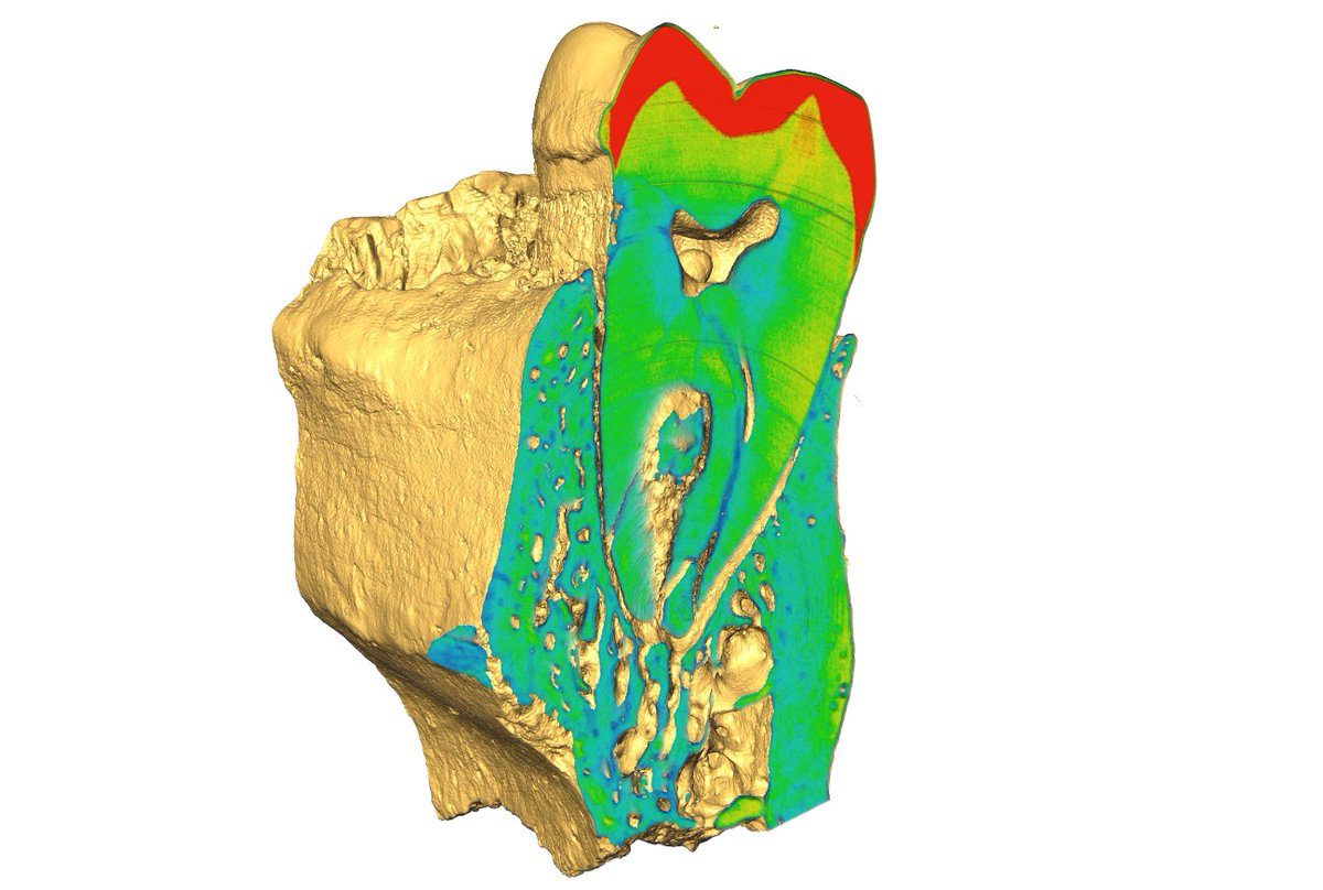 PPBioImaging's tweet image. Bones & Teeth, Past & Present!
With microCT, Ricardo Miguel Godinho (@ICArEHB ) uncovers hidden structures. Thanks to the Bioimaging Platform (@i3S) node of PPBI, open-access imaging fuels discovery beyond PPBI!
#Bioimaging #MicroCT #PPBI #i3S #FossilAnalysis