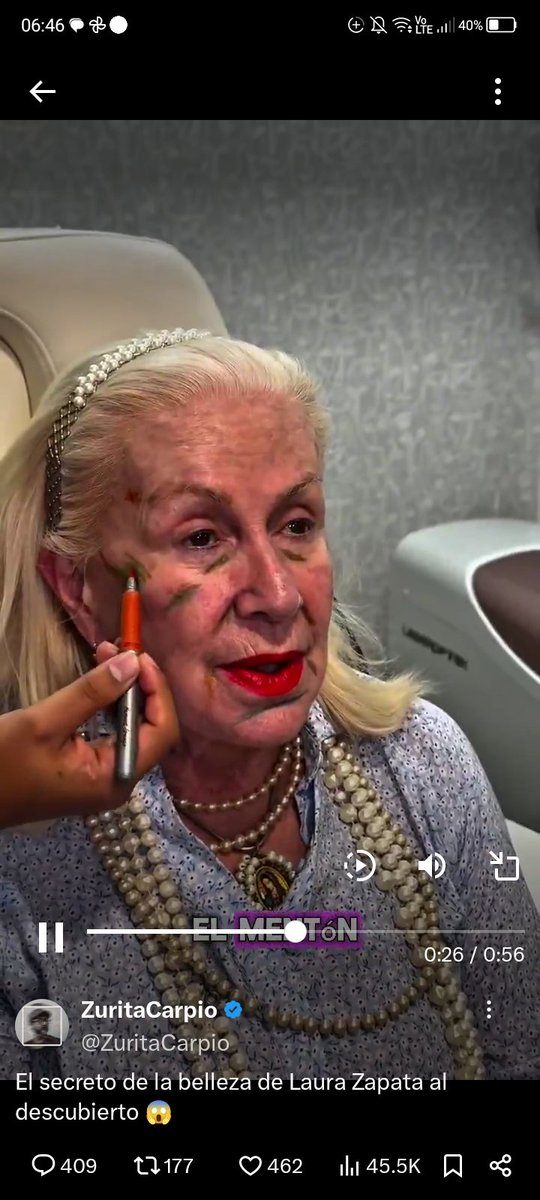 CamilaAlec23412's tweet image. Voy a demandar a X por daño psicólogico me despierto y prendo.mi celular 📱 y veo esta ching@der@ que me asusto 😱🫣 no hagan eso.@LAURAZAPATAM  ya ni la ching@$ Bruja,momia viviente ,estás fea como tu alma .