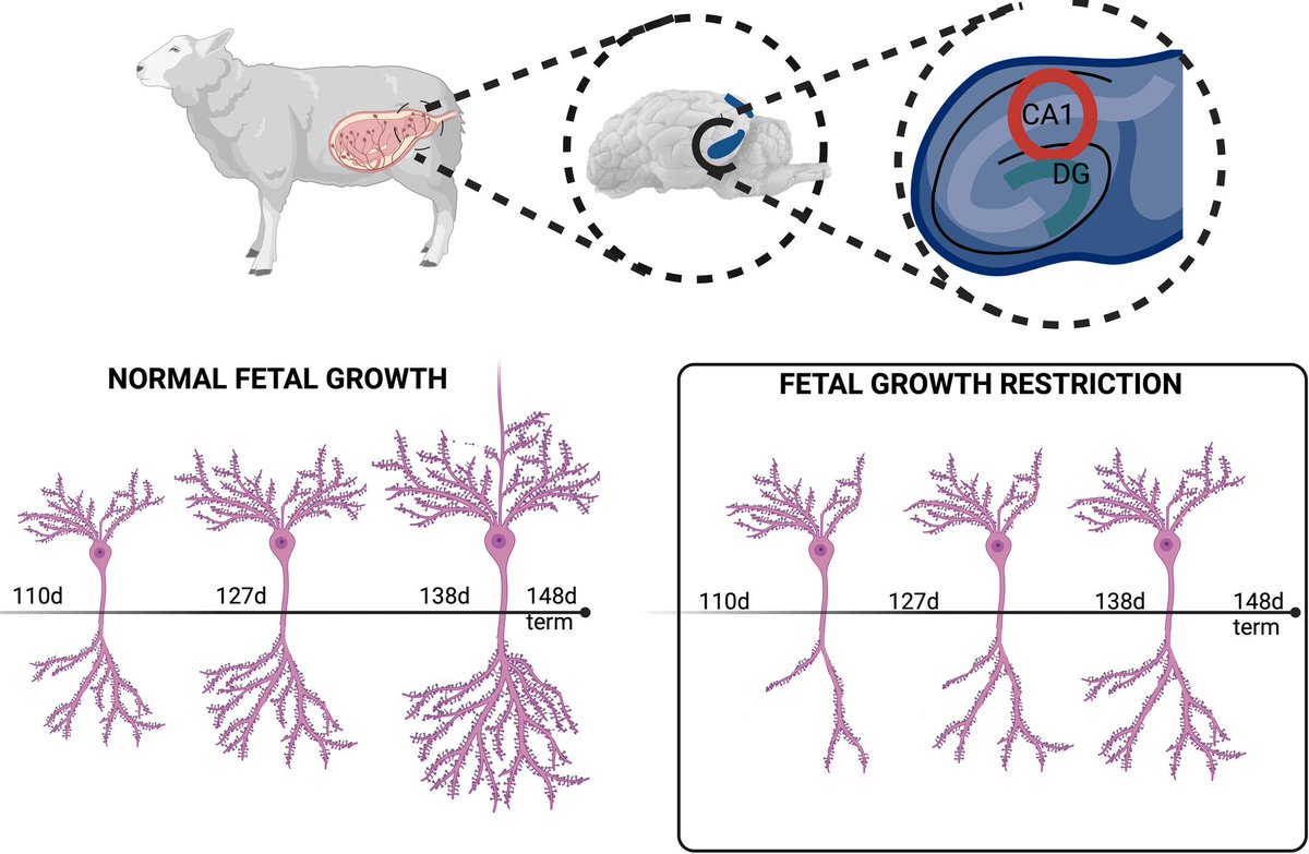 brainpathol's tweet image. Fetal growth restriction adversely impacts trajectory of hippocampal neurodevelopment and function onlinelibrary.wiley.com/doi/10.1111/bp…