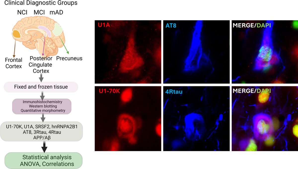 brainpathol's tweet image. Spliceosome protein alterations differentiate hubs of the default mode connectome during the progression of Alzheimer's disease
onlinelibrary.wiley.com/doi/10.1111/bp…