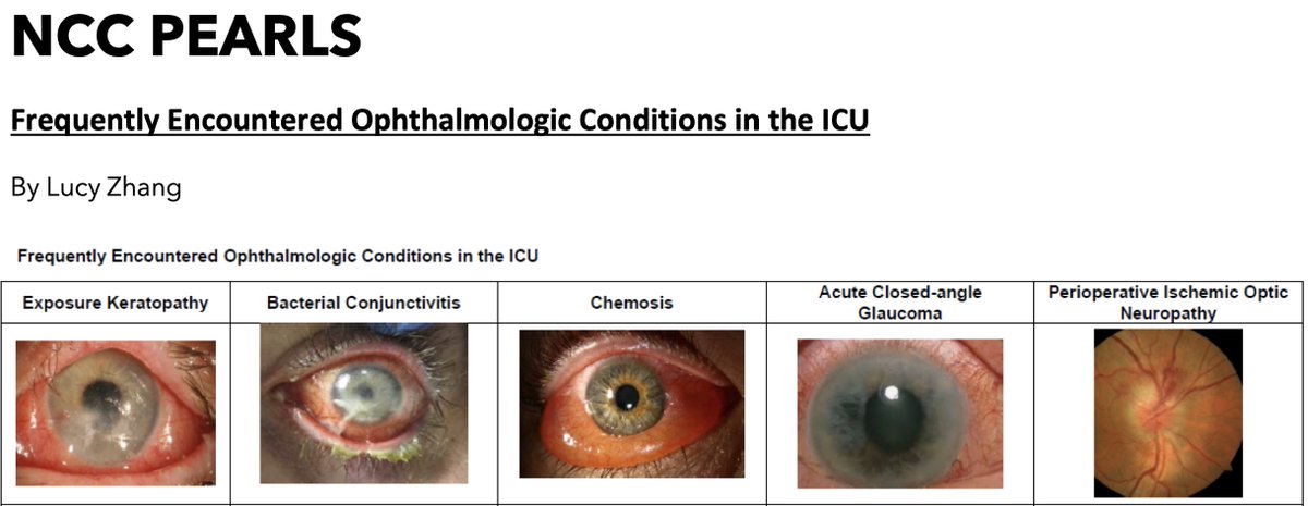 Did you know the SCCM neuroscience section makes an awesome Newsletter?! <a href="/senelson13/">Sarah Nelson, MD, MPH, FAAN, FNCS</a> and team fill it with great summaries of key recent trials, ongoing research and some neuro pearls! Become a member of the Neuroscience community to get it in your mail! tinyurl.com/yc5t3x3y
